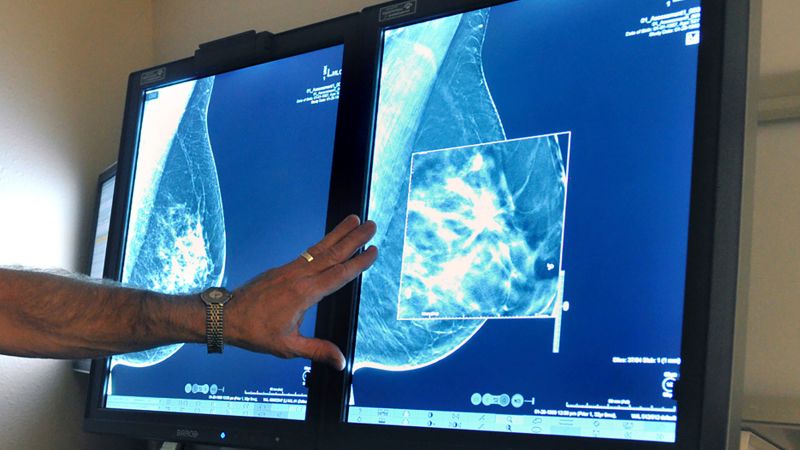 Doctors push back against the European study that casts doubts on the effectiveness of colonoscopies.