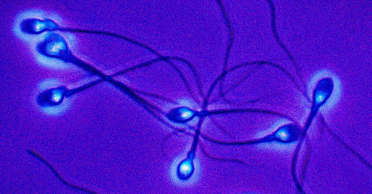 There is a novel male birth control that could be an on-off switch for sperm