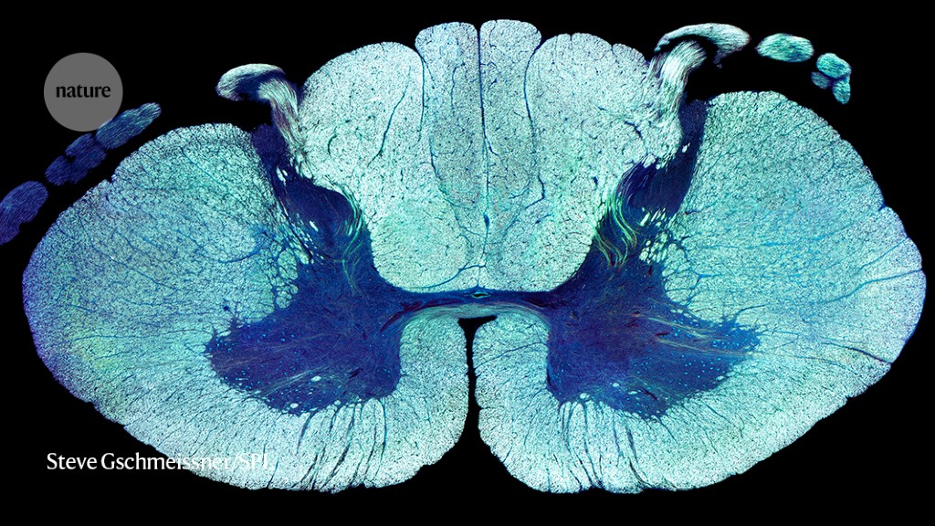 Years after a stroke, sciatic nerve stimulation is able to improve arm and hand movement