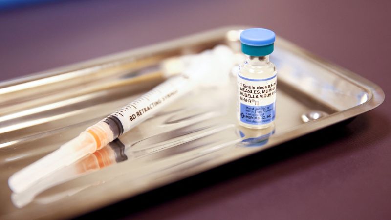 What is the difference between a mild case of measles and a severe case?