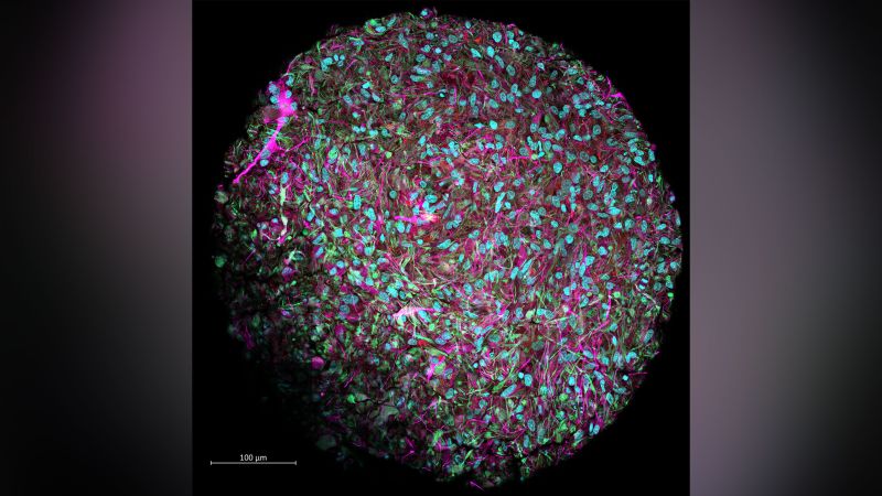 Human brain tissue can be grown in a lab