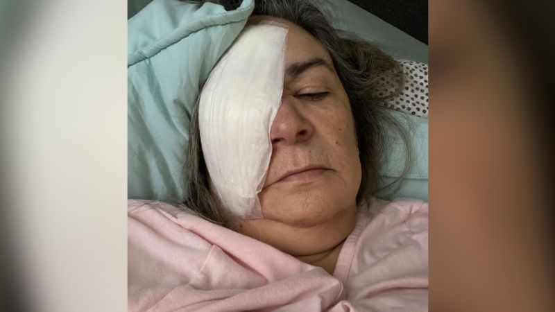 People who have had eye drops recalled describe permanent vision problems