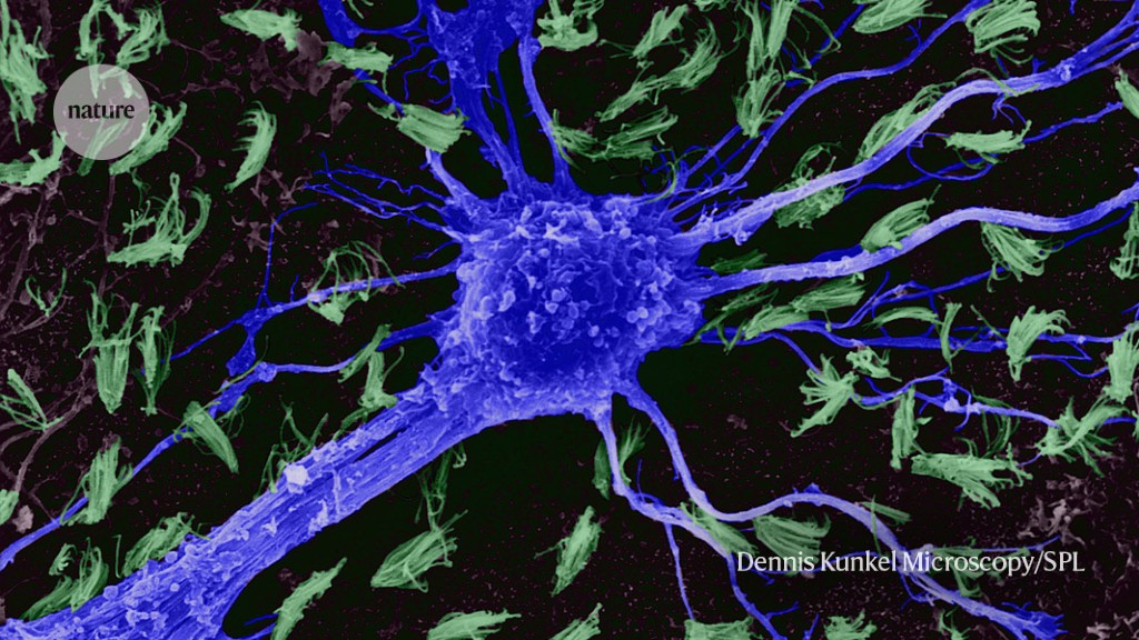 A ground-breaking Human Brain Cell Atlas is just about to be released