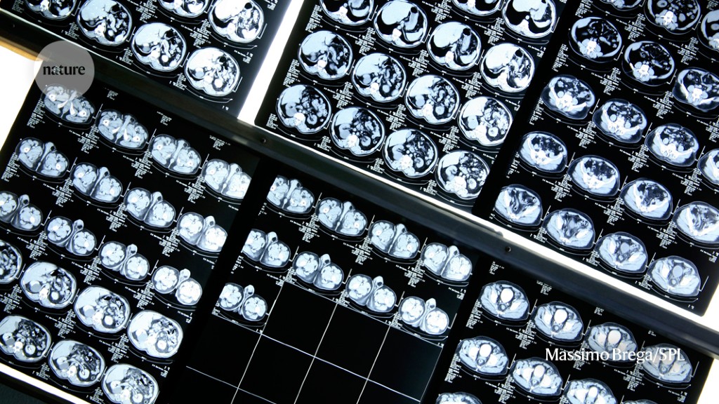 Doctors could make better diagnoses with the help of artificial intelligence