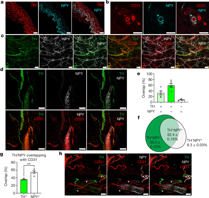 The Y protects against food related diseases by sustaining thermogenic fat