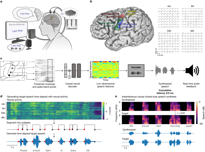 A voice-synthesis device